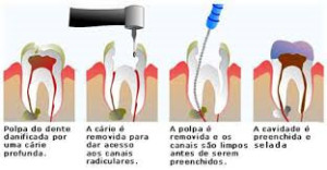 endodontia1